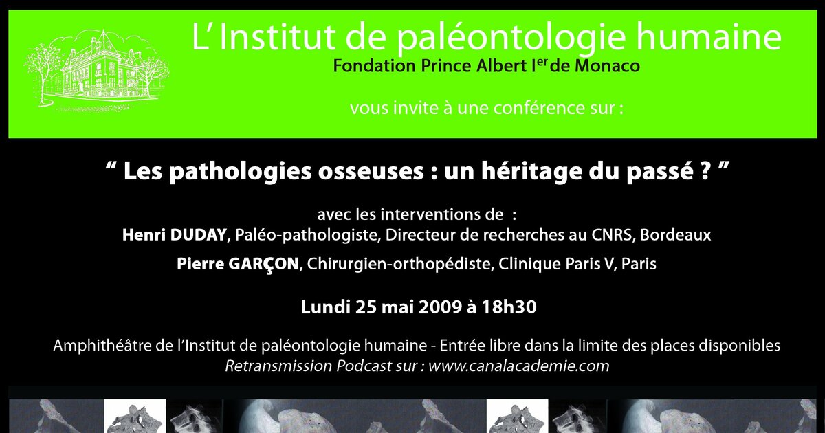 Les pathologies osseuses, un héritage du passé ? - Institut de